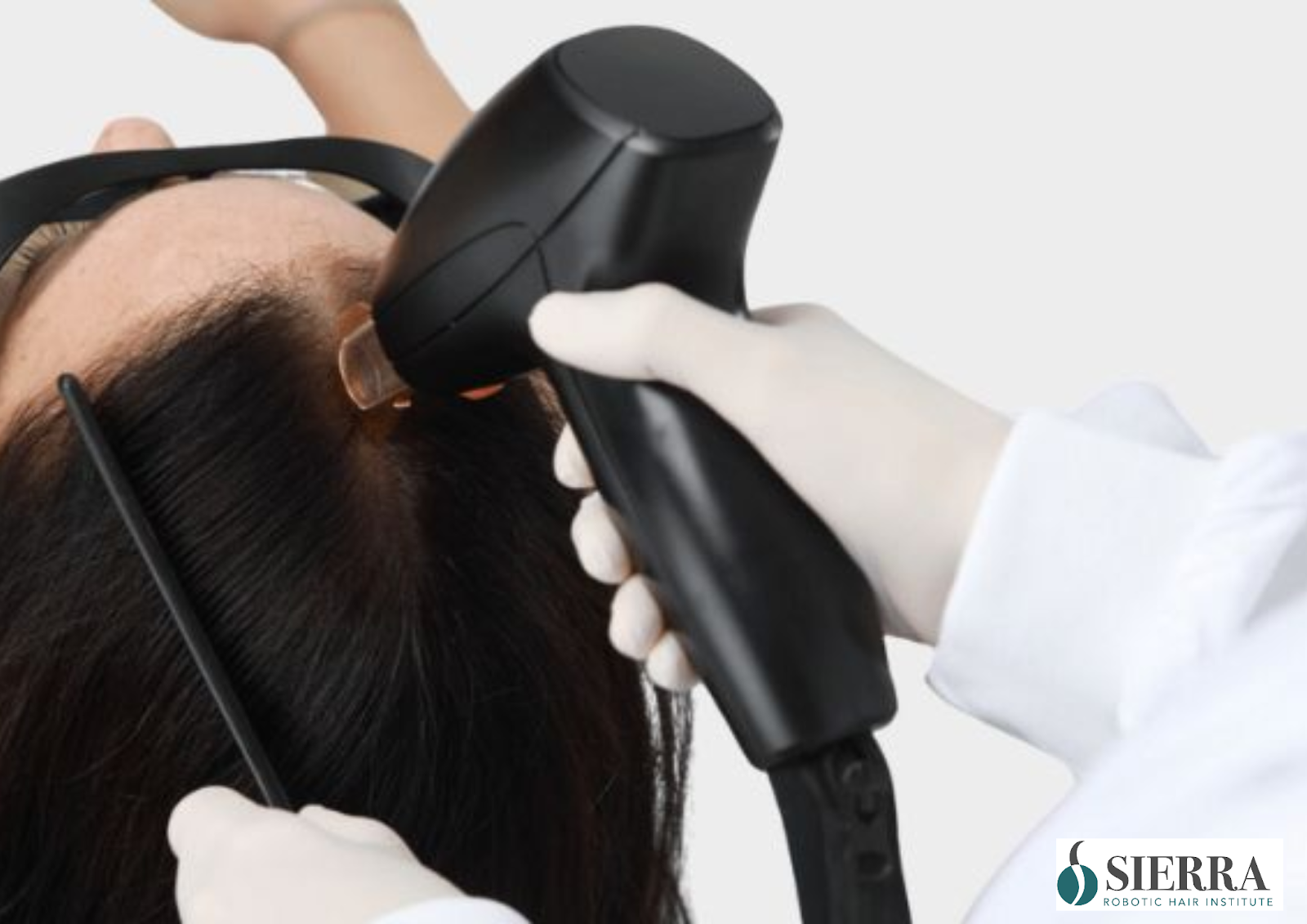 Types of Hair Restoration Therapies