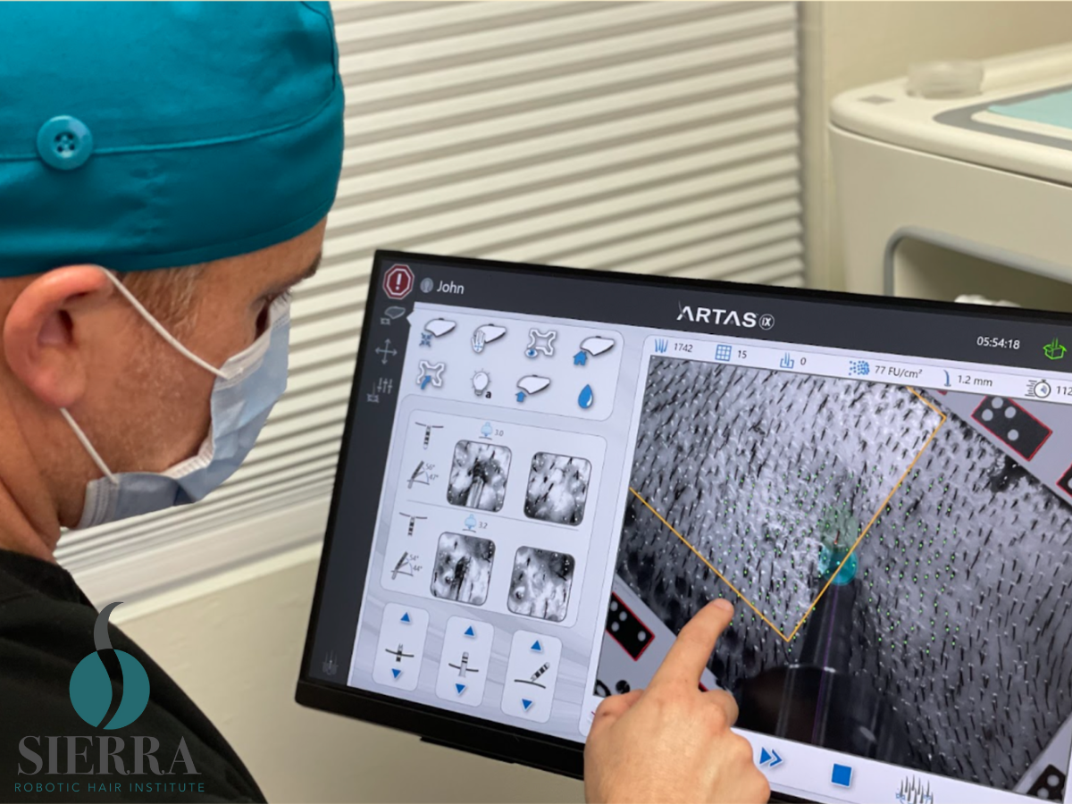 How Robotic FUE Transplants Compare To Traditional Methods Risks, Benefits & Outcomes With Sierra Robotic Hair Institute