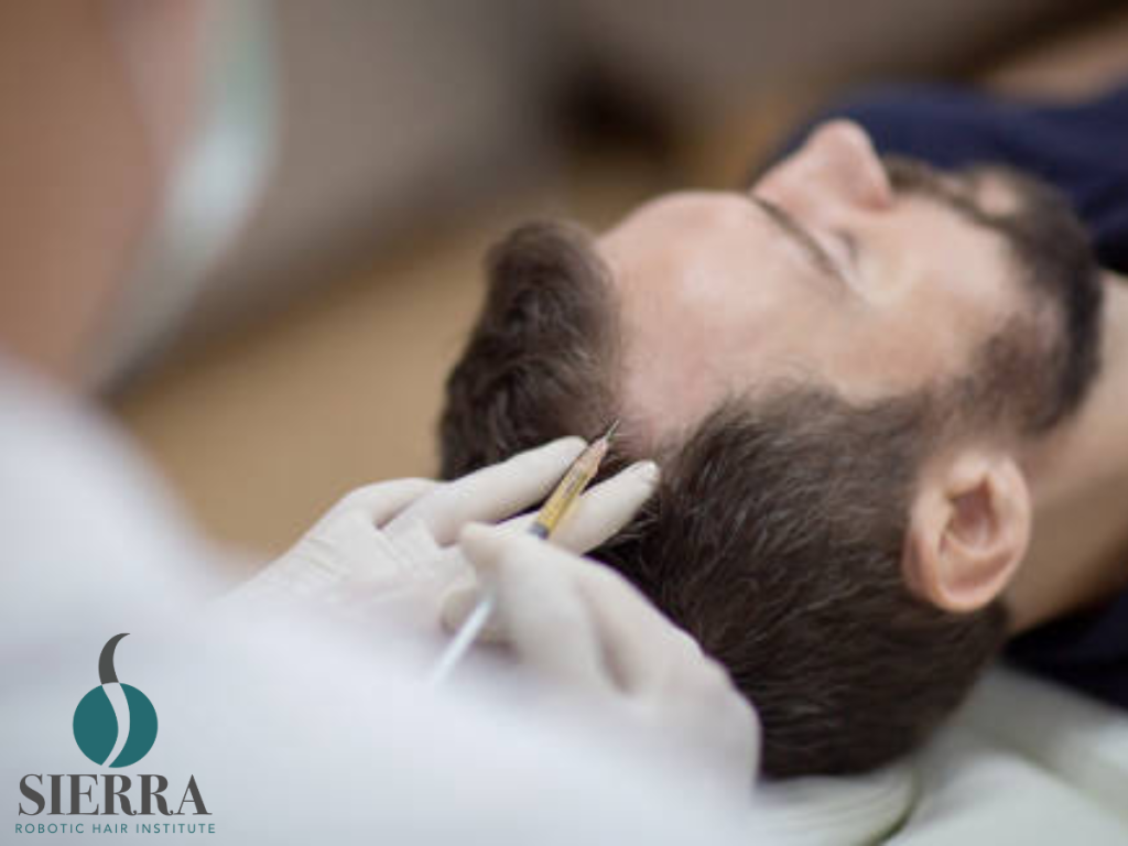 Non-Surgical Hair Restoration Options In Fort Lauderdale With Sierra Robotic Hair Institute