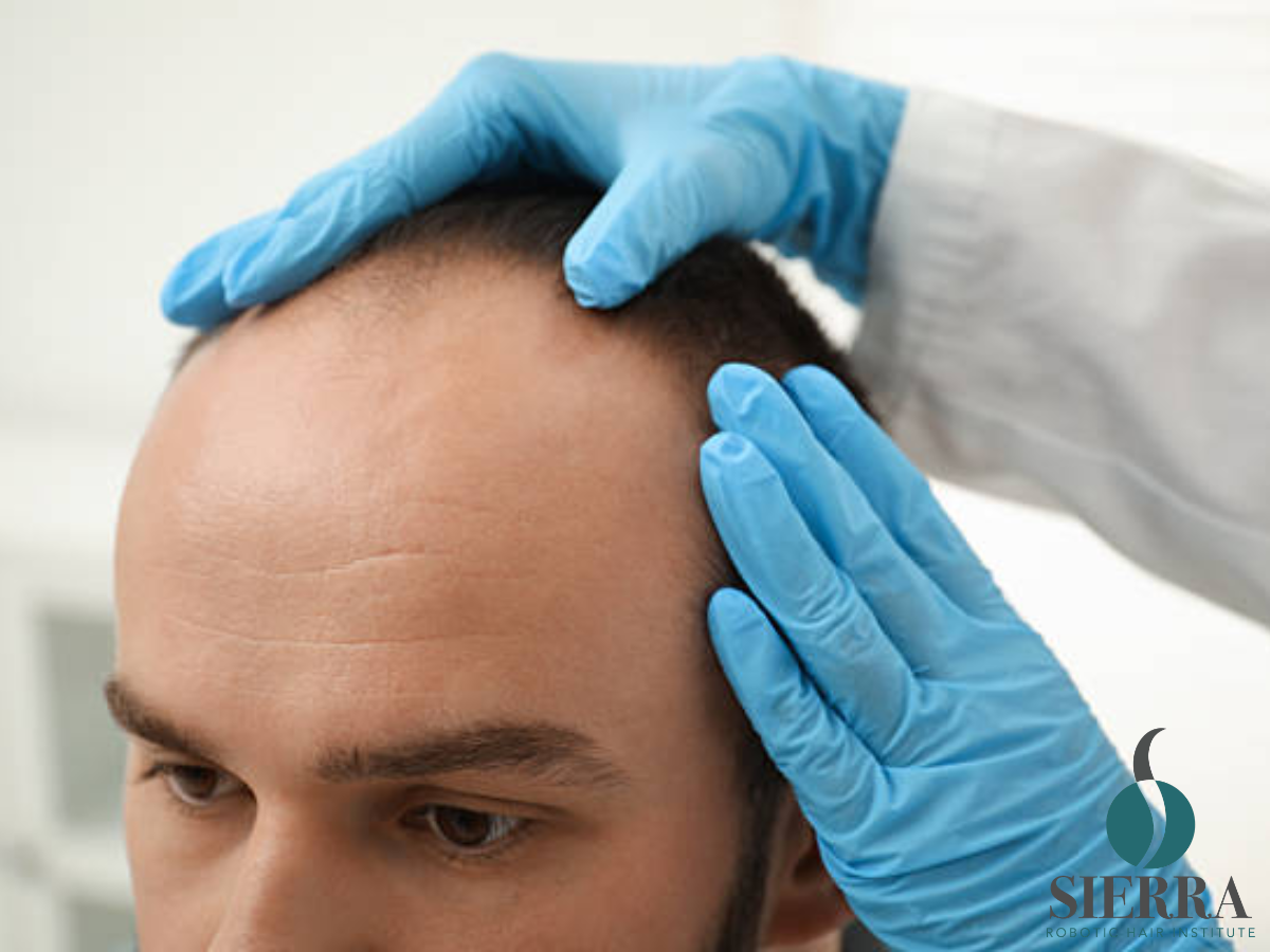 A Fully Customized Hair Restoration Approach