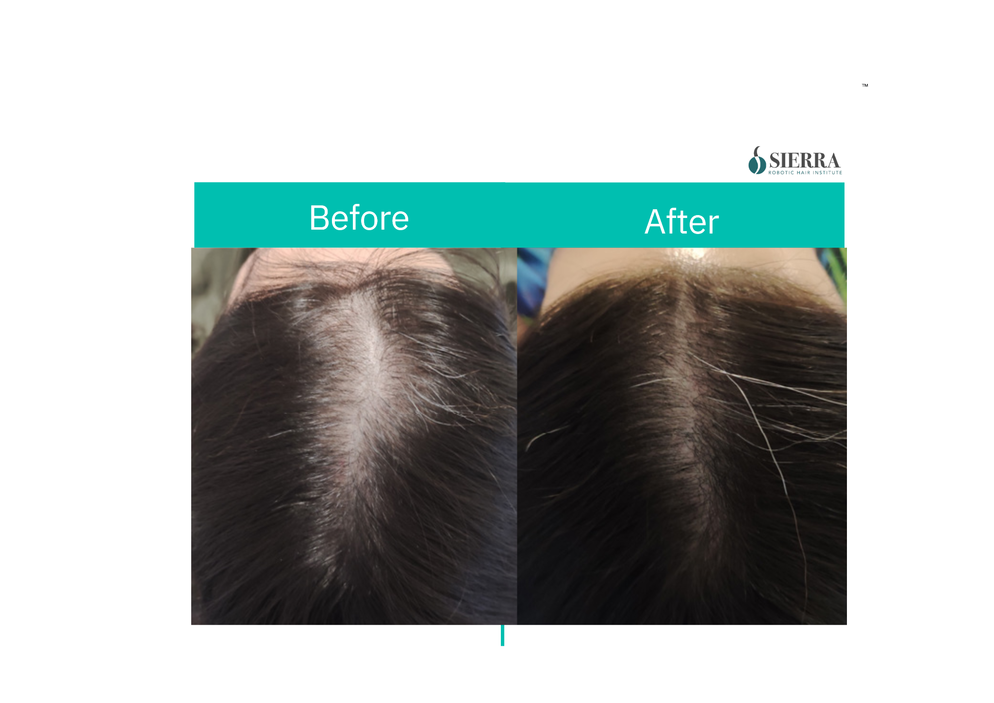 Benefits of Proper Nutrition and Hair Growth